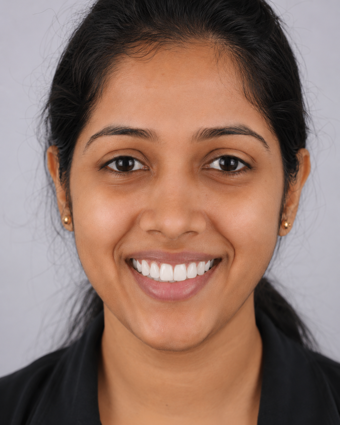 After smile design and whitening - patient smiling with beautifully designed and whitened smile